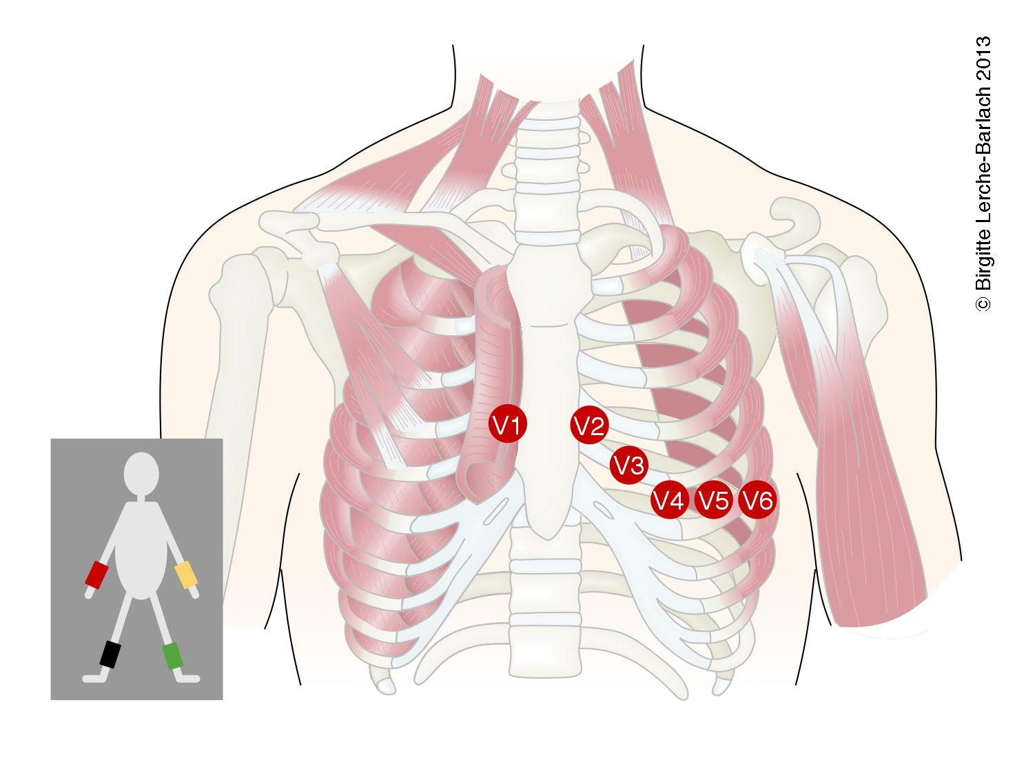EKG Ved Angina Og Blodprop I Hjertet Patienth ndbogen P Sundhed dk ekg-ved-angina-og-blodprop-i-hjertet-patienth-ndbogen-p-sundhed-dk