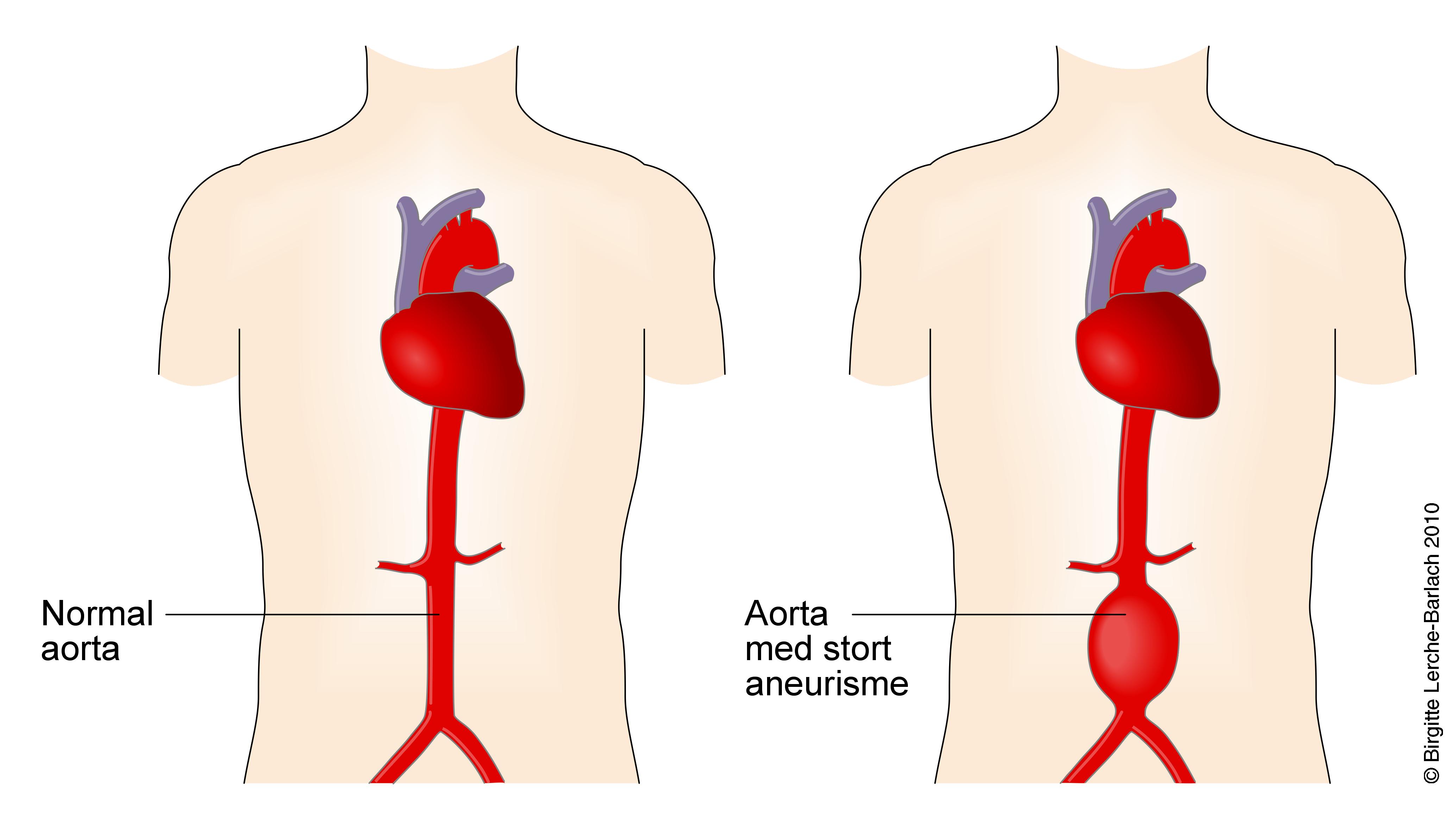 joanne-s-story-of-ectopic-heart-beats-and-stomach-problems-the