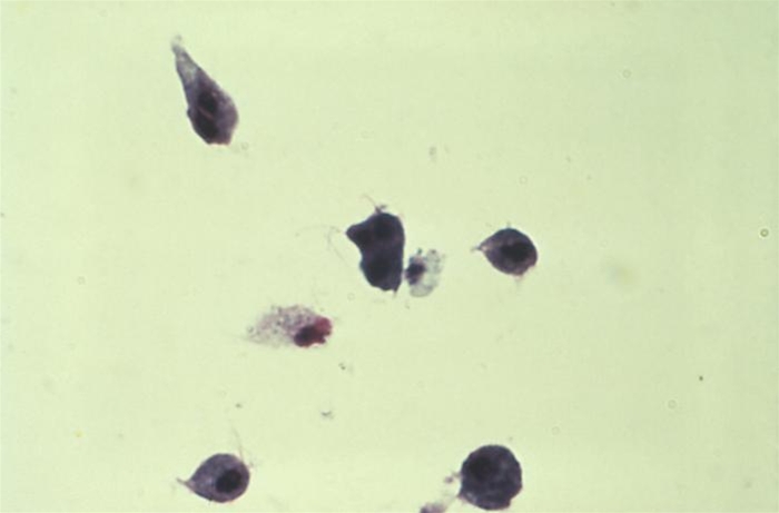 Trichomonas metilénkékkel festett kenetekben férgekben a férgek milyen tüneteket mutatnak