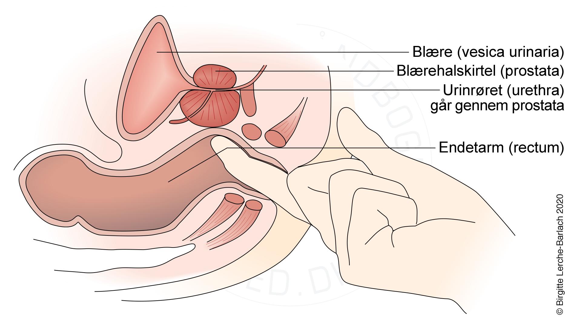 Levomecitin a prostatitis alatt