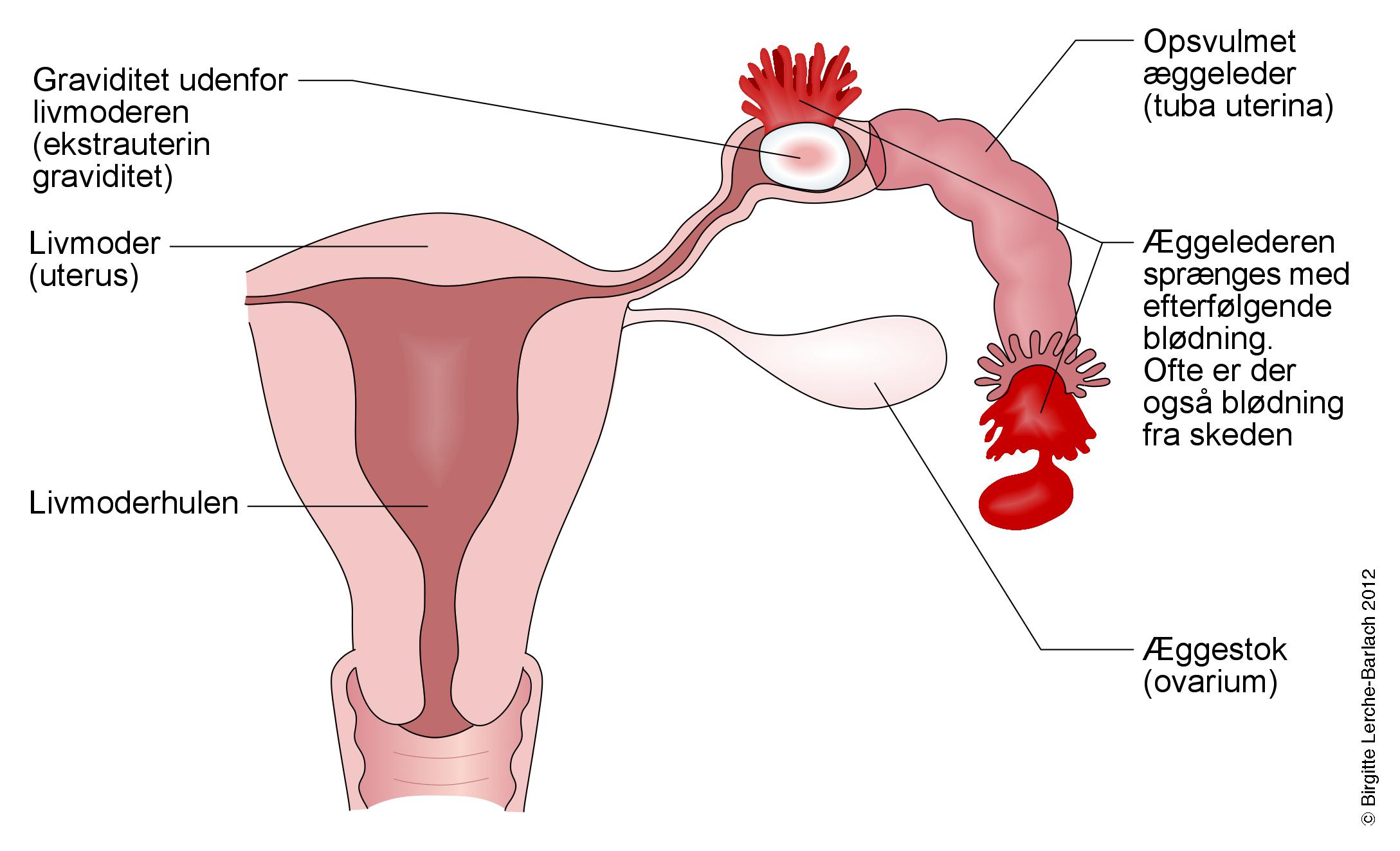 Kan man tage graviditetstest når man har menstruation
