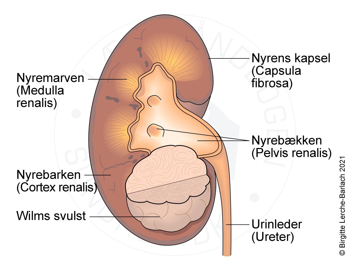 Wilms - Patienthåndbogen sundhed.dk