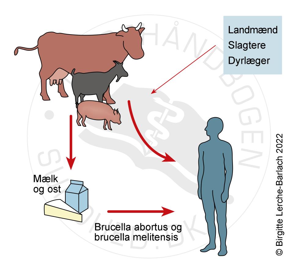 Brucellose - Patienthåndbogen på sundhed.dk